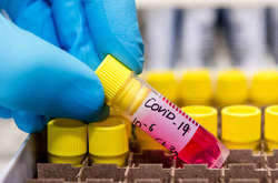 26 случаев за сутки: количество инфицированных Covid-19 в Украине выросло до 73