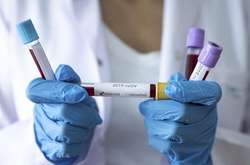 У Києві ще чотири нові випадки захворювання на коронавірус