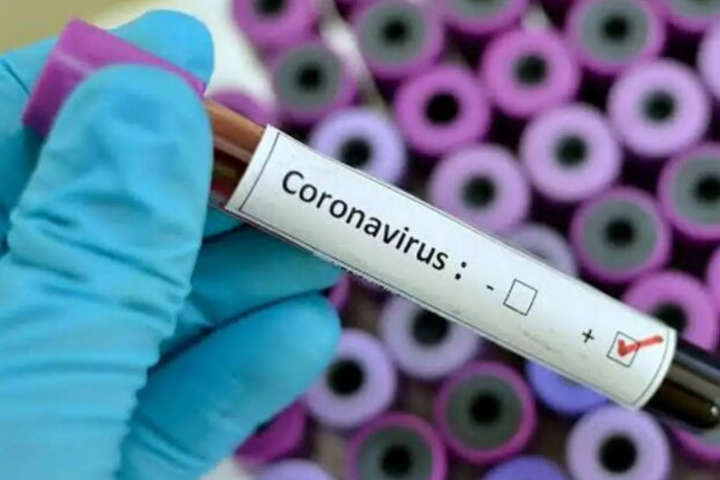 На Київщині підтвердили коронавірус у вагітної жінки