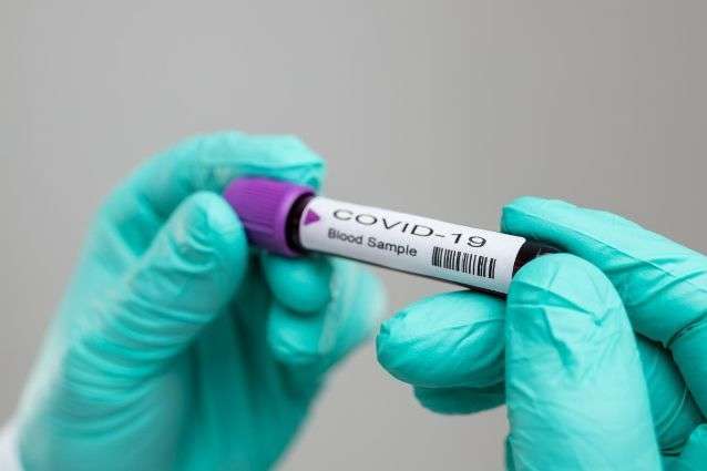 Кількість хворих на коронавірус в Києві зросла до 31