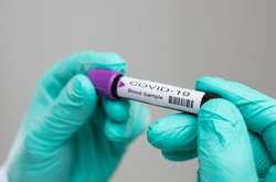 Кількість хворих на коронавірус в Києві зросла до 31