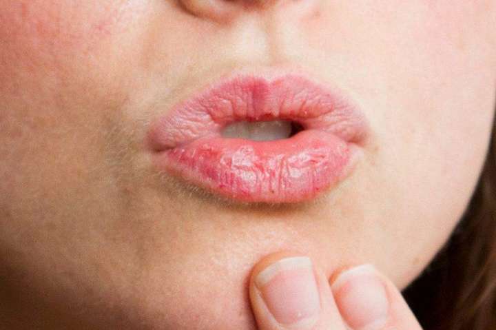 Новые признаки коронавируса. Обращайте внимание на состояние губ и восприятие запахов