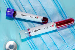 У Києві та області вже 58 хворих на коронавірус