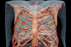 Коронавірус спочатку потрапляє в слизові оболонки, а потім «спускається» у легені