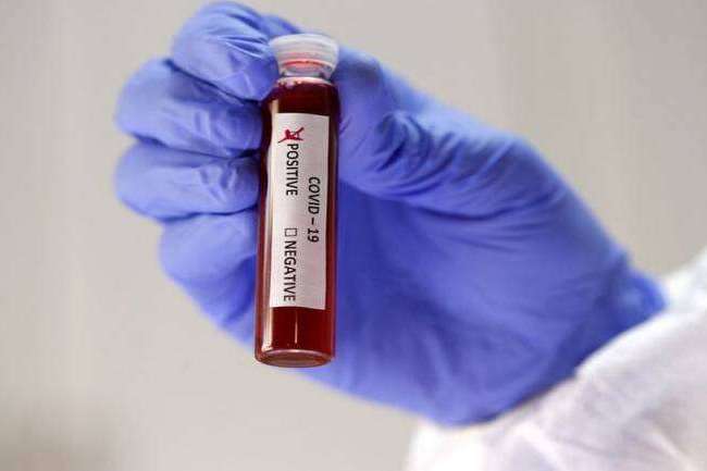 Німці винайшли швидкий тест на коронавірус