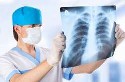 Хворих на пневмонії прийматимуть окремі лікарні Києва