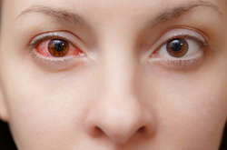 Виявлено нову ознаку коронавірусу. Зараження можна визначити по очах