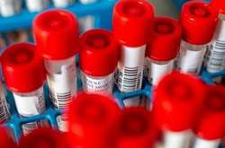 П’ятеро людей вже одужали – повторне лабораторне дослідження не виявило вірусу в організмі