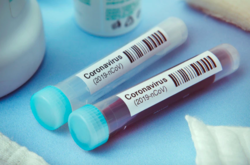 Станом на 22:00 29 березня в Україні 475 лабораторно підтверджених випадків COVID-19