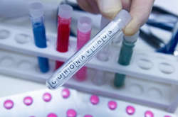 Кількість хворих на коронавірус у Києві перевищила сотню осіб