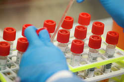 Коронавірус на Київщині: в яких районах найбільше хворих