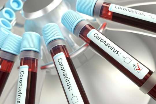 Одеситка хвора на коронавірус перебувала у звичайній лікарні вісім днів, поки волонтери їй не зробили тест