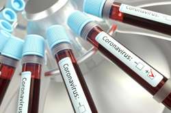 Одеситка хвора на коронавірус перебувала у звичайній лікарні вісім днів, поки волонтери їй не зробили тест