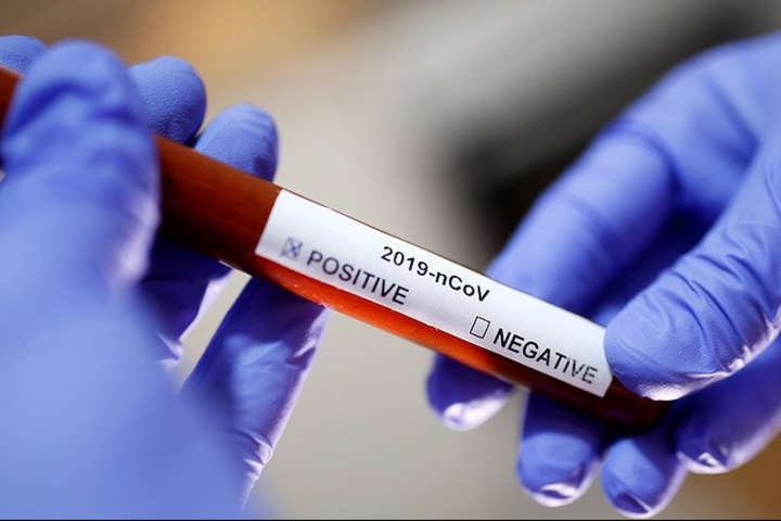 У «ДНР» визнали перший випадок інфікування коронавірусом