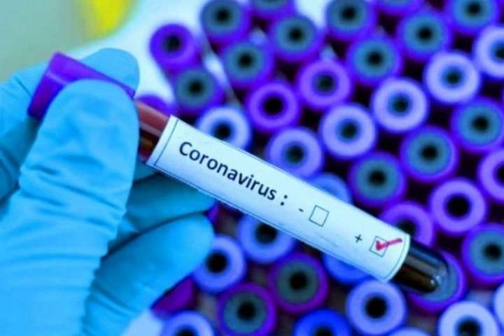 На Вінниччині лабораторно підтверджено 54 випадки захворювання на коронавірус