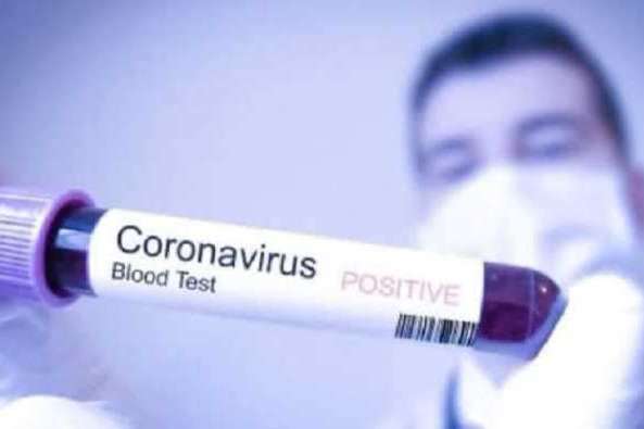 В Україні за добу від коронавірусу померли семеро людей, – МОЗ