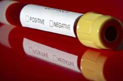 На Львівщині помер другий пацієнт, у якого було зафіксовано коронавірусну інфекцію