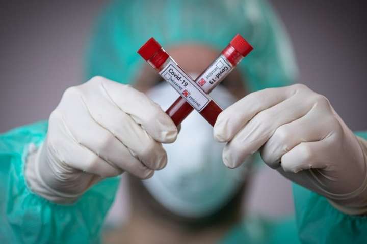 Риск заболеть коронавирусом зависит от группы крови