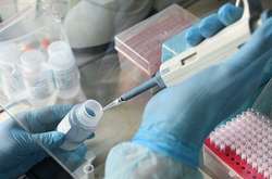 В Україні за добу зафіксовано 311 нових випадків коронавірусу