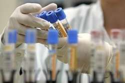 У Києві вже 348 випадків коронавірусу - МОЗ