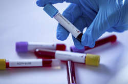  У Києві для тестування на коронавірус має бути направлення лікаря 