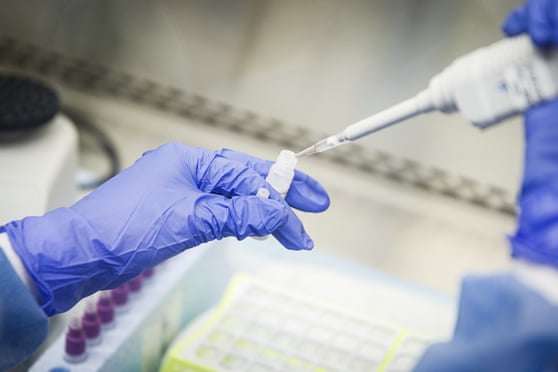 В Білорусі заявили, що не потребують російських тестів для коронавірусу