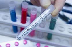 На Одещині підтверджено 63 випадки інфікування Covid-19