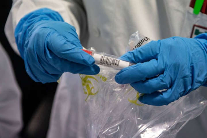 На Хмельниччині ще одна людина померла від коронавірусу