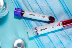 Всього в Україні внаслідок ускладнень від Covid-19 померли 83 людини, з них 40 чоловіків та 43 жінки