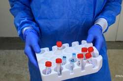 МОЗ запускає тестування на антитіла до Covid-19