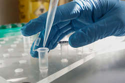 Тест дозволить виявляти наявність коронавірусу вже через 24 години після зараження, стверджують розробники