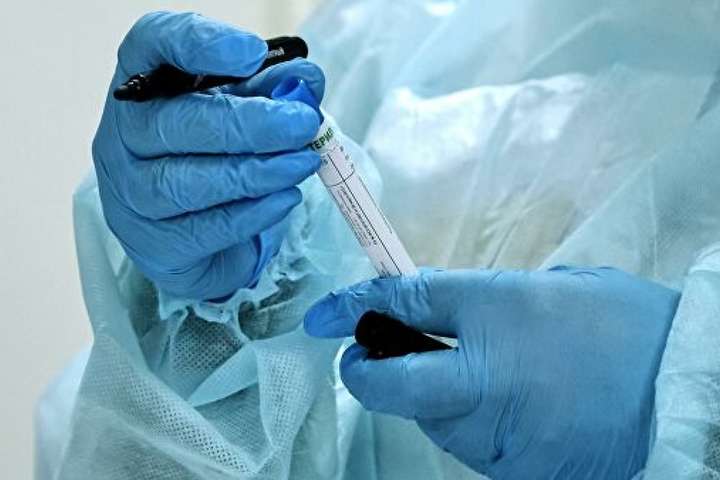 Ученые сообщили о пяти кожных проявлениях коронавируса