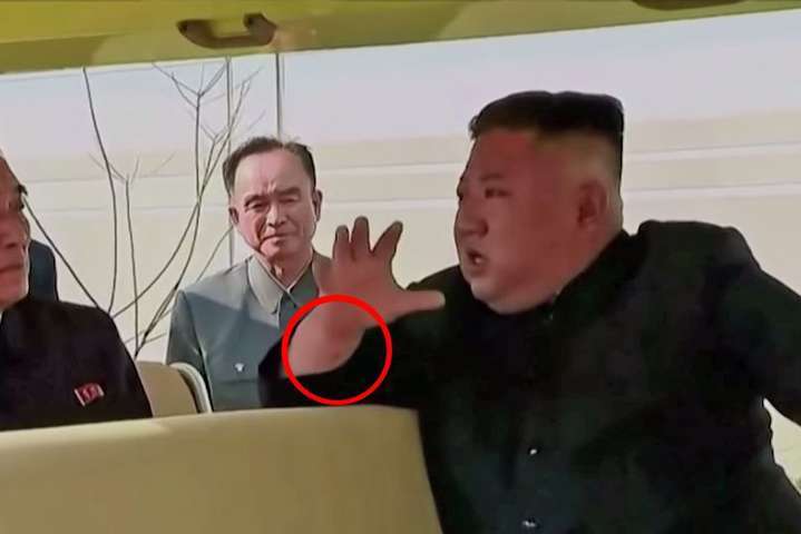 На руке Ким Чен Ына обнаружили загадочный след
