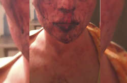 У Житомирі група молодиків пів ночі знущалася з 19-річного гея 