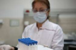Во Львовской области делают по 220-250 ПЦР-тестов в сутки