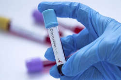 На Черкащині жінка з підозрою на Covid-19 розповіла про те, як до неї поставились односельчани