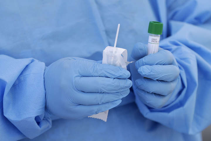 МОЗ відновило переговори з виготовлення вітчизняних тестів на коронавірус