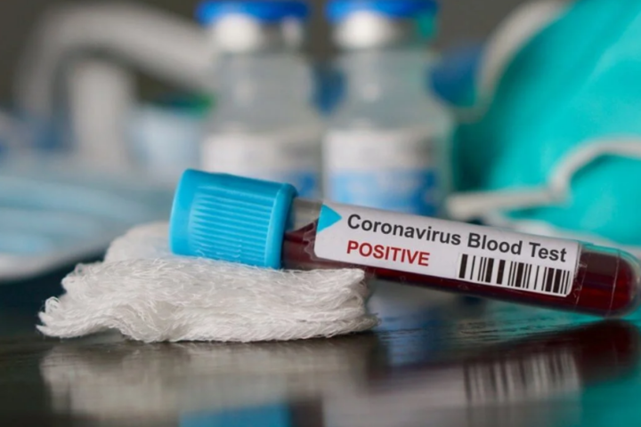 1% пацієнтів у Китаї, які вже вилікувалися від коронавірусної інфекції, згодом&nbsp;знову захворіли - Рецидив може статися у тих, хто вилікувався від Covid-19