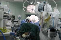 У Вухані пересадили легені пацієнту, який переніс Covid-19