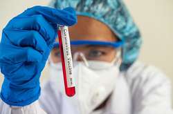 На Вінниччині підтверджено 580 випадків захворювання на коронавірус