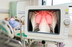 Оперативні дані МОЗ. За добу від Covid-19 одужала рекордна кількість українців