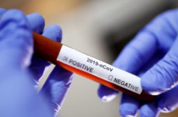 За останню добу в Одесі зареєстровано п'ять нових випадків зараження коронавірусом