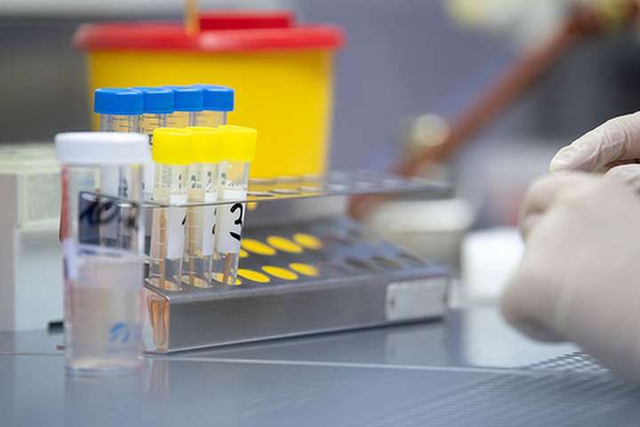 В Сінгапурі розробили новий експрес-тест для визначення антитіл до коронавірусу
