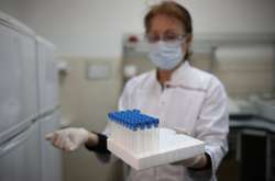 За результатами дослідження на Буковині офіційно підтверджено ще 47 випадків зараження коронавірусом