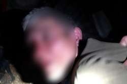 У Дніпрі біля психлікарні знайшли оголене тіло 12-річного хлопчика