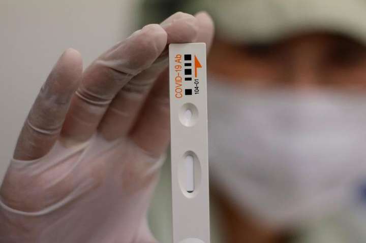 МОЗ України планує тестувати на антитіла до коронавірусу: що відомо про ІФА-тести