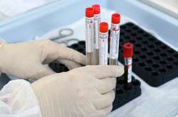 В Украине зафиксировано 19 706 лабораторно подтвержденных случаев Covid-19