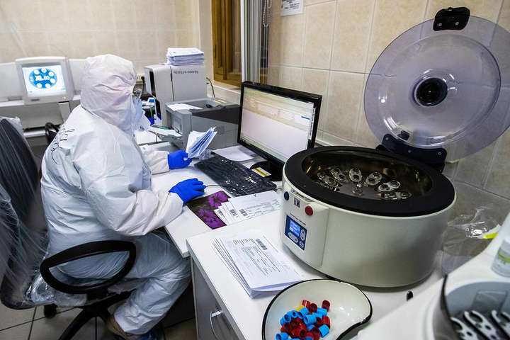 У Москві оголосили про масове безкоштовне тестування на антитіла 