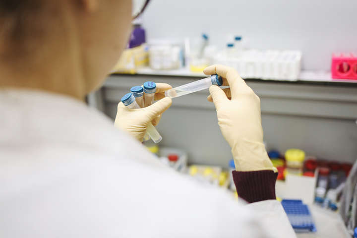 МОЗ залучить лабораторії центрів з боротьби з ВІЛ та Держпродспоживслужби до тестування на коронавірус