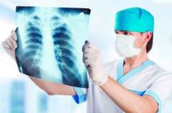 У стаціонарах київських медзакладів лікуються 307 хворих на пневмонію